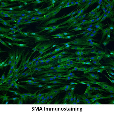 Immortalized Human Aortic Smooth Muscle Cells Innoprot