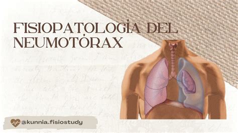 Fisiopatológica del Neumotorax KUNNIAFISIOSTUDY uDocz