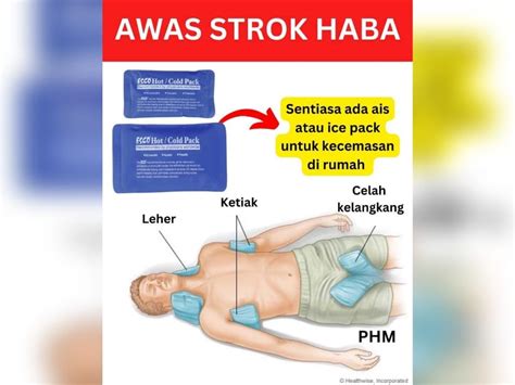 Pek Ais Bantuan Awal Pulihkan Mangsa Strok Haba Kosmo Digital