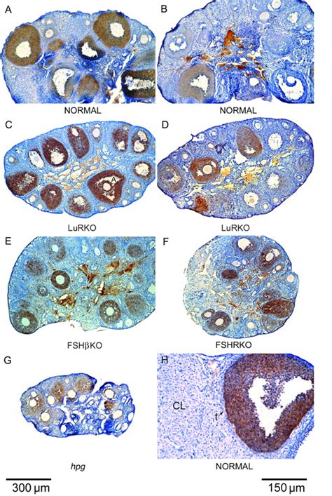 Influence Of Mutations Affecting Gonadotropin Production Or