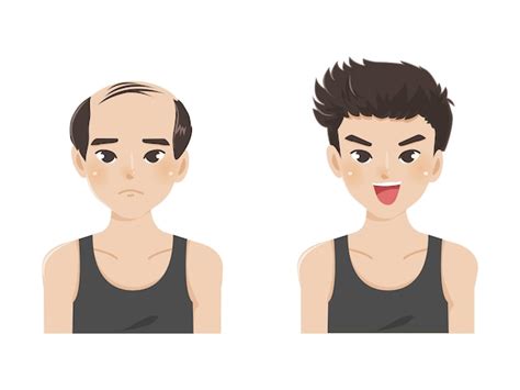 Ilustração do vetor dos desenhos animados de um homem calvo cabelo