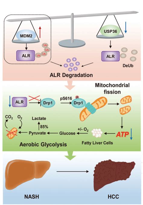 基础医学院安威谢萍教授团队《oncogene》阐述肝再生增强因子蛋白稳定性失衡促进脂肪肝向肝癌发展的机制 首医要闻 首都医科大学新闻网