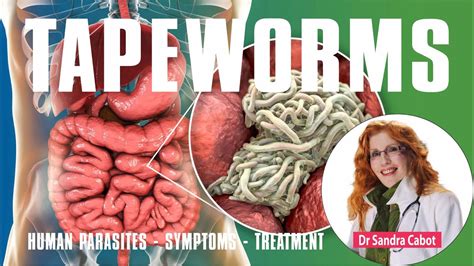 Tapeworms Get Rid Of Tapeworms Roundworm Causes Symptoms