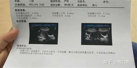 怀孕后，胎心、胎芽多久才会出现？出现时间早晚受这三个原因影响 知乎