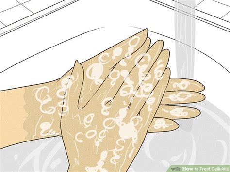 How To Diagnose And Treat Cellulitis Doctor Approved Advice