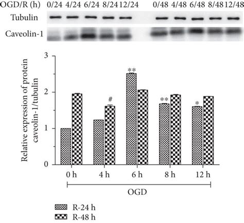 The Effect Of Apigenin On Cell Viability Of HBMVECs With OGD R Was