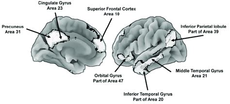 Key Brain Areas Of The Default Mode Network That Support The Download Scientific Diagram