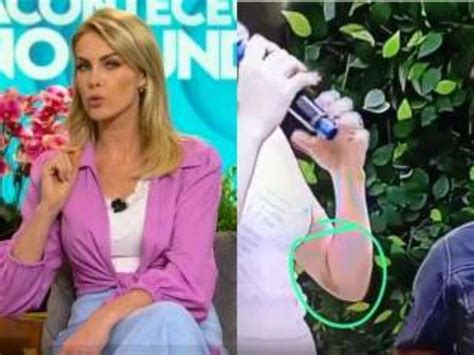 Ana Hickmann Apresenta Programa Roupa Que Deixou Hematoma No Bra O