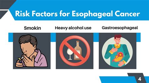 Ppt Things To Know About Esophageal Cancer Powerpoint Presentation Free Download Id12189762