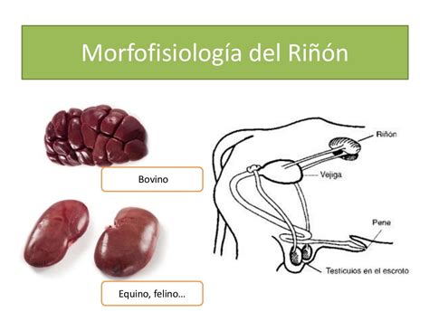 Patología Sistema Urinario