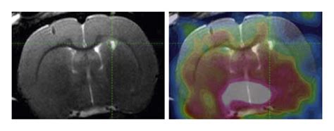 In Vivo Pet Imaging With C Pib T Wi Mri Is Shown In The Left Column