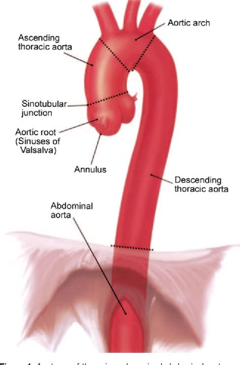 Bulb Of Aorta Semantic Scholar