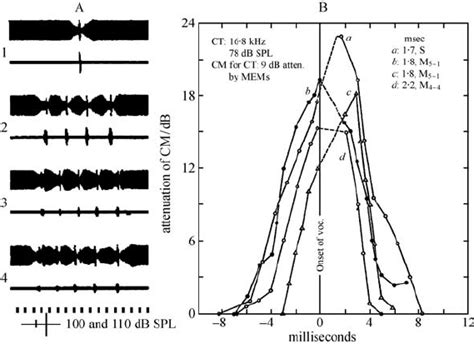 A The Time Course Of The Vocal Middle Ear Muscles Mem Contraction Of Download Scientific