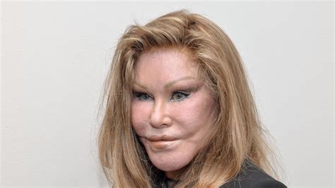 Jocelyne Wildenstein surnommée la femme chat est morte à 79 ans