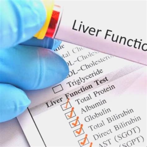 Liver Function Tests Information About Its Types And Purposes