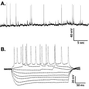 Representative Waveforms Showing A Spontaneous Action Potentials From