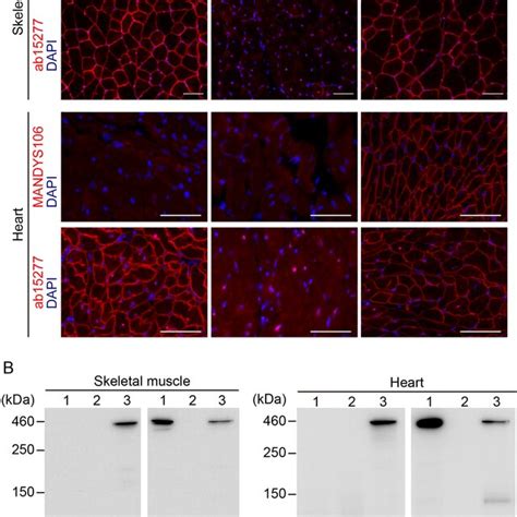 Expression Of Human Dystrophin Derived From Human Artificial Chromosome