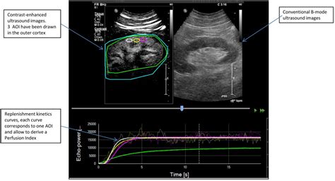 Bench To Bedside Review Contrast Enhanced Ultrasonography A