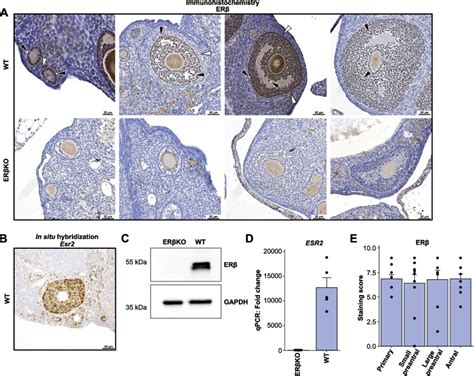 Ovarian Erβ Cistrome And Transcriptome Reveal Chromatin Interaction