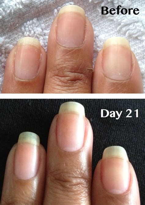 Peeling Nails Pure Nail Oil And Cuticle Oil Challenger Beckys Results