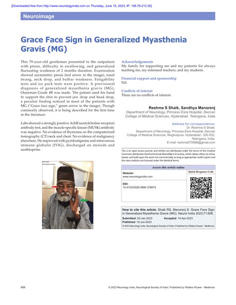 Pdf Grace Face Sign In Generalized Myasthenia Gravis Mg