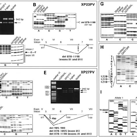 Mutations In The Ddb2 Gene Of The Xp23pv Xp25pv And Xp27pv Families