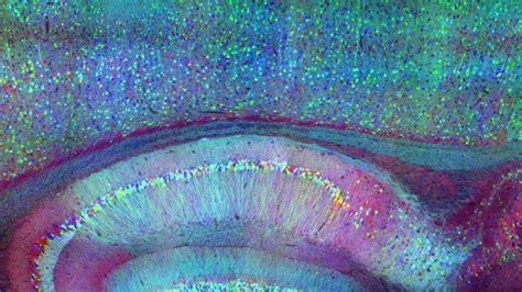 Fluorescent Brain Probe Visualizes Groups Of Neurons As They Compute