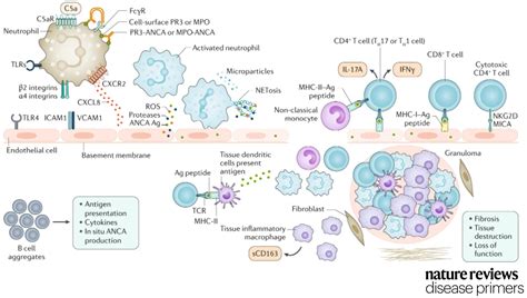 Nature Reviews Disease Primers On Twitter Anti Neutrophil Cytoplasmic