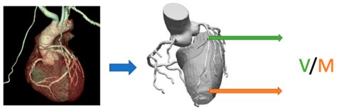 Coronary Microvascular Dysfunction And The Role Of Noninvasive