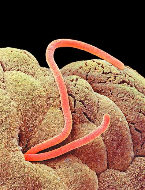 Threadworms In The Gut Sem Photograph By Science Photo Library