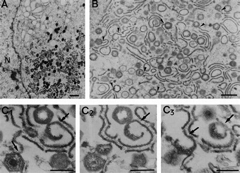 Ultrathin Epon Sections Of Viral Factories In Asfv Infected Vero Cells