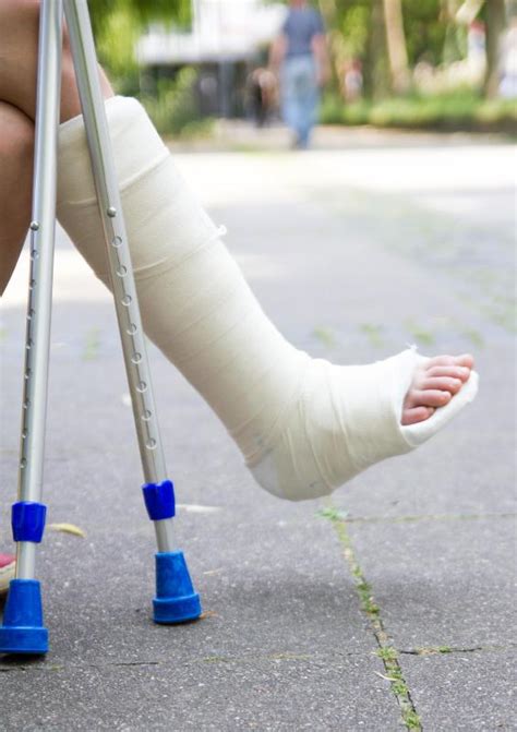 What Is A Cast Cover With Pictures