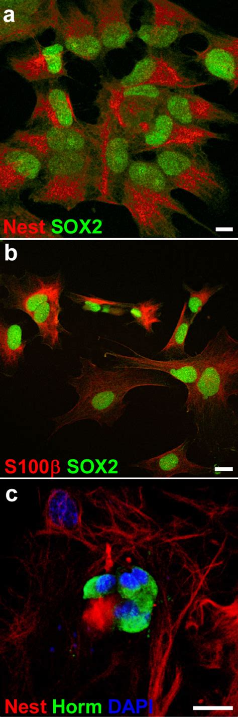 Sox2 Expressing Progenitor Cells Generate All Of The Major Cell Types