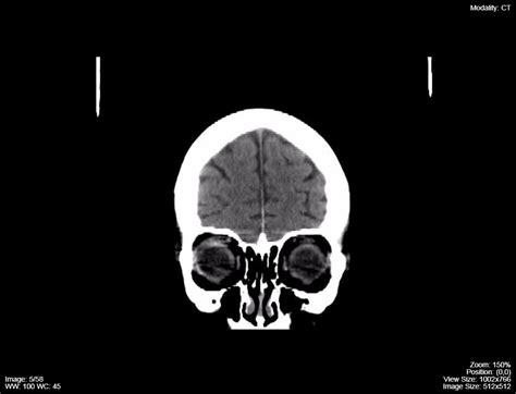 Computed Tomography Ct Undergraduate Diagnostic Imaging Fundamentals