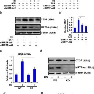 MRTF A Deficiency Attenuates CTGF Induction In Vitro A A B B HK 2