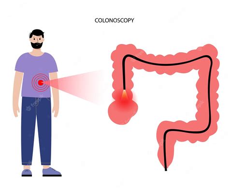 Premium Vector | Colonoscopy procedure concept