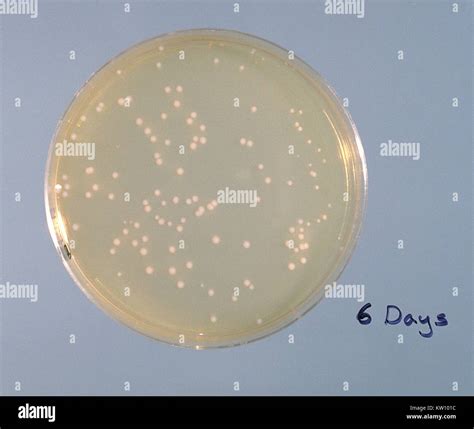 Legionella Pneumophila Cultivo Fotograf As E Im Genes De Alta