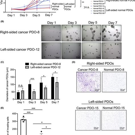 Cell Proliferation And Invasion Capability Of Patientderived Organoid