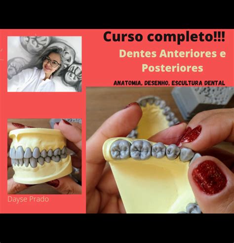 Dentes Anteriores E Posteriores Anatomia Desenho Escultura Dayse