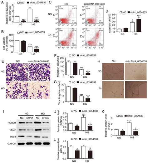 Human Circular Rna Regulates High Glucoseinduced Vascular