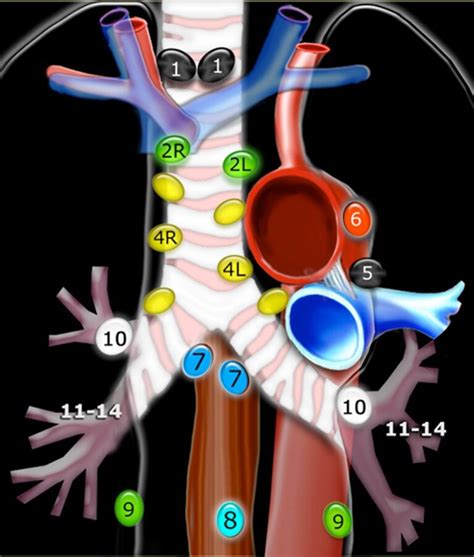 Lymph Node Stations In The Mediastinum Lymph Node Stations 3a And B Download Scientific