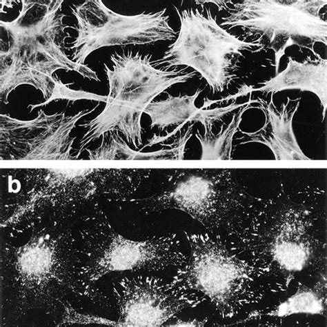 Recombinant Rho Stimulates Formation Of Focal Adhesions And Stress Download Scientific Diagram