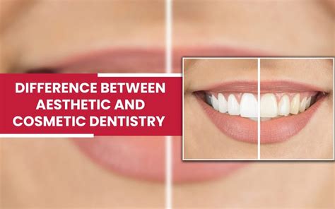 Difference Between Cosmetic And Aesthetic Dentistry Wilmot