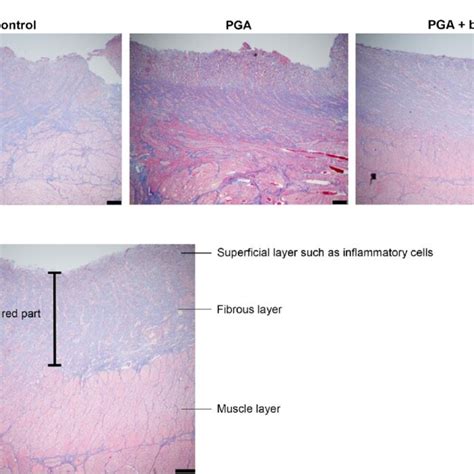 Elastica Masson Staining And The Fiber Thickness A Elastica Masson