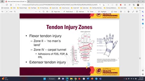 The Wrist And Hand Complex Flashcards Quizlet