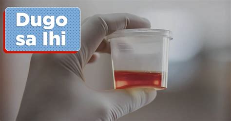 Dugo Sa Ihi Hematuria Sintomas At Sanhi Mediko Ph