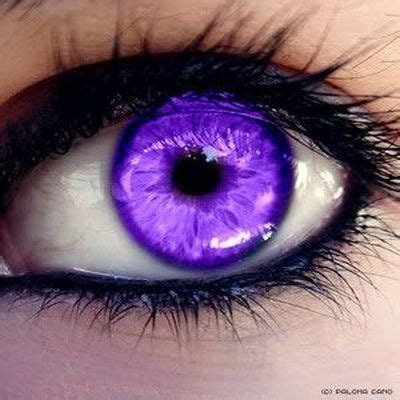 Purple Eye Disease - Symptoms And Causes