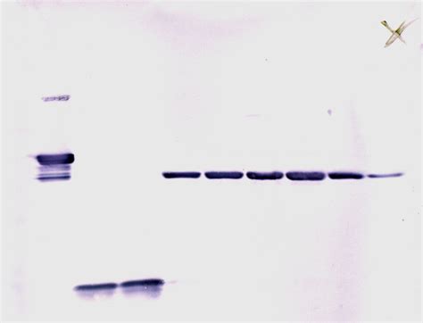 Western blot - wikidoc