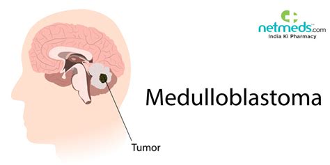 Rachel Wheeler Kabar: Medulloblastoma Symptoms Adults