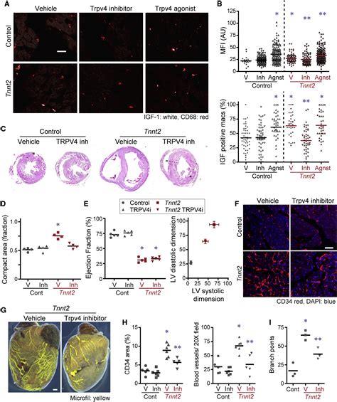 Resident Cardiac Macrophages Mediate Adaptive Myocardial Remodeling